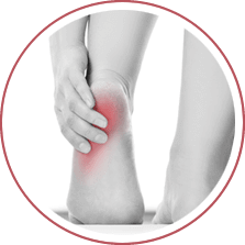 Heel Pain Treatment in the New York Mills, Utica, NY 13417 area