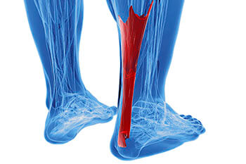 achilles tendonitis treatment in the New York Mills, Utica, NY 13417 area